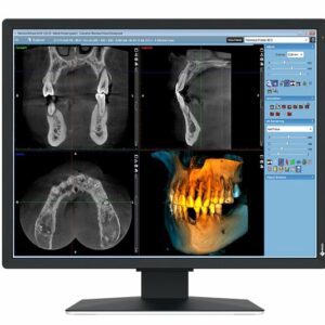 Monitor Eizo 21" MX217-SB